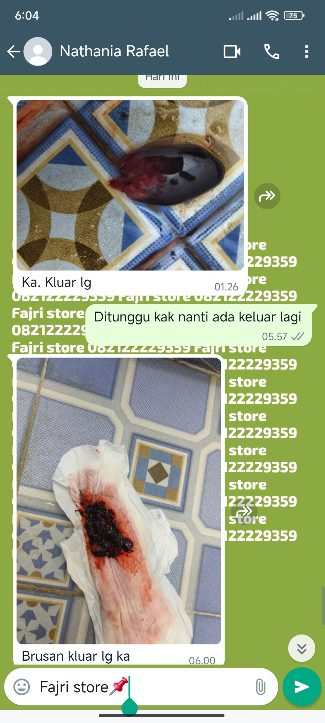 Apotik Jual Obat Aborsi 082122229359 Cytotec Garut COD Misoprostol