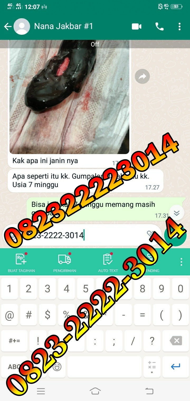 Jual Penggugur Cytotec Jakarta Pusat ^082322223014^ Jual Misoprostol Klinik Dokter Ternama